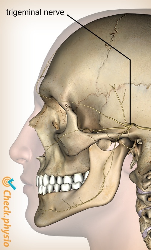 head cervicogenic headache CGH trigeminal nerve