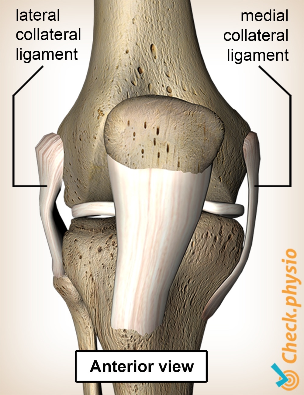 Medial knee ligament injury