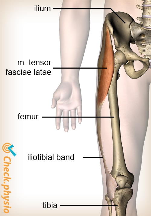 Iliotibial band syndrome