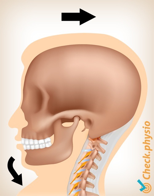 neck whiplash pain movement 1