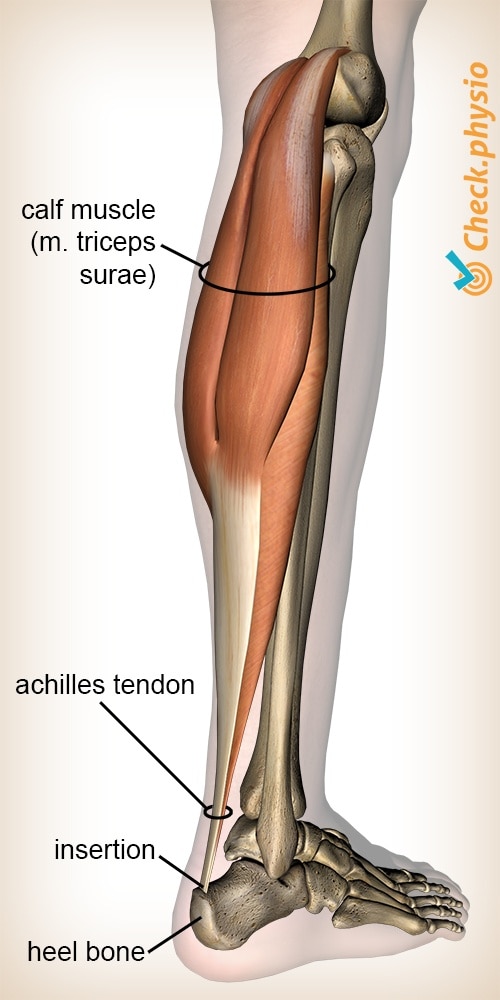 How Did Achilles Die? Let's Look Closer at His Story