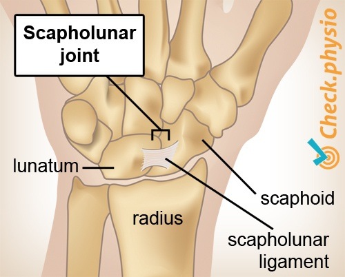 wrist scapholunar joint