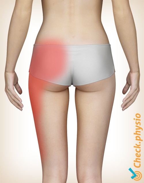 https://www.physiocheck.ca/images/artikelen/24/pelvis-SI-joint-pain-location.jpg