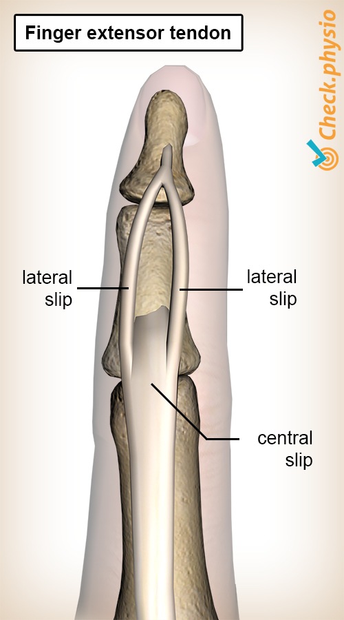finger extensor tendon slips central slip lateral slip