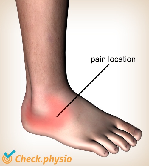 ankle lateral ankle ligament injury pain location inversion trauma