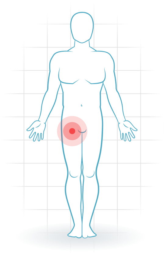 pijnlocatie Osteoarthritis of the hip