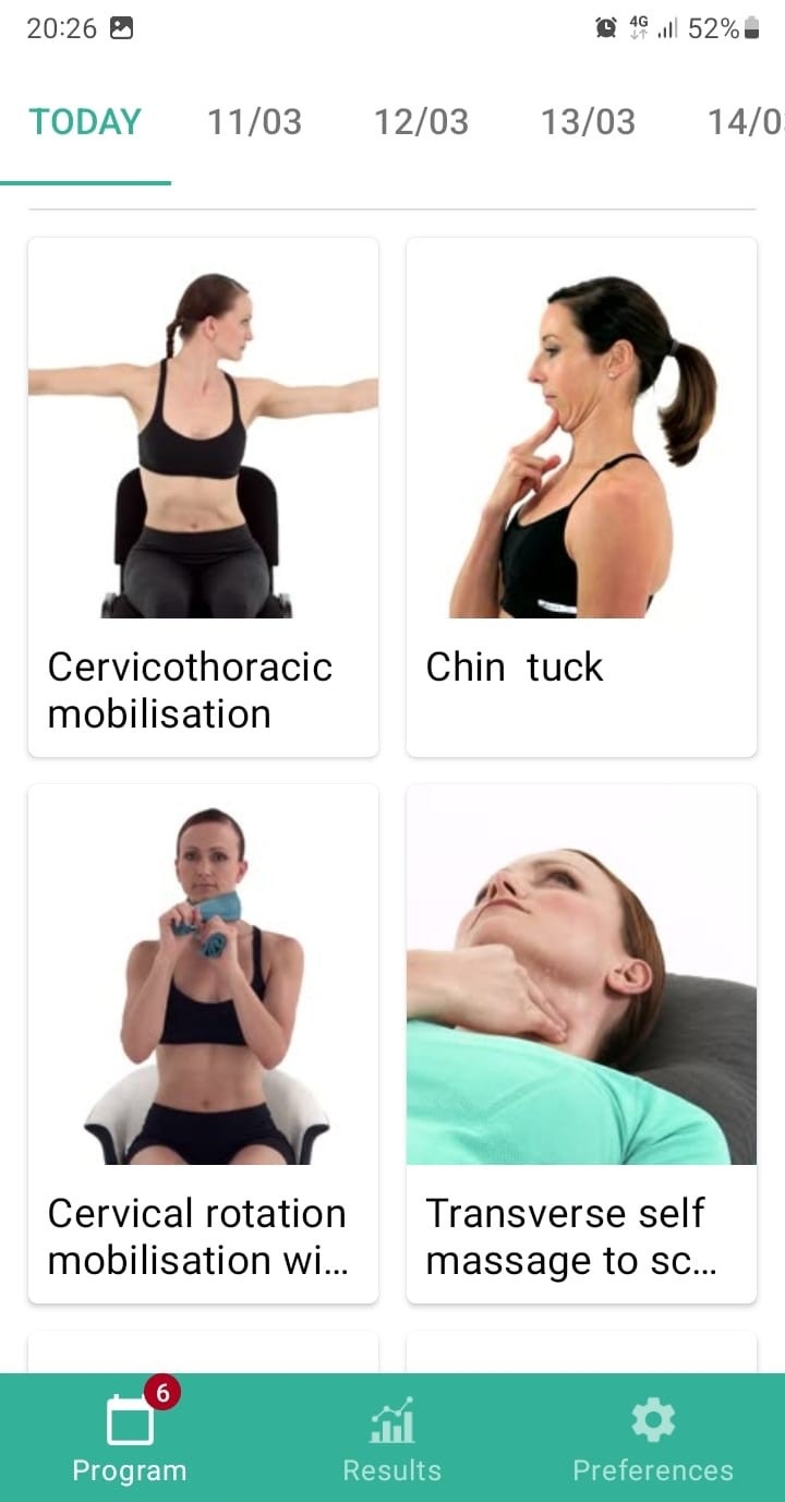 Cervical radiculopathy exercise program